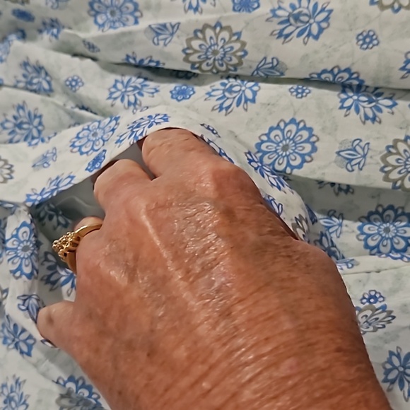 HERSY MEDALLION PRINT BABYDOLL DRESS M NWOT - Picture 7 of 13